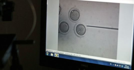 An egg being fertilized and displayed on a screen