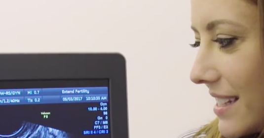 A woman looking at an ultrasound screen