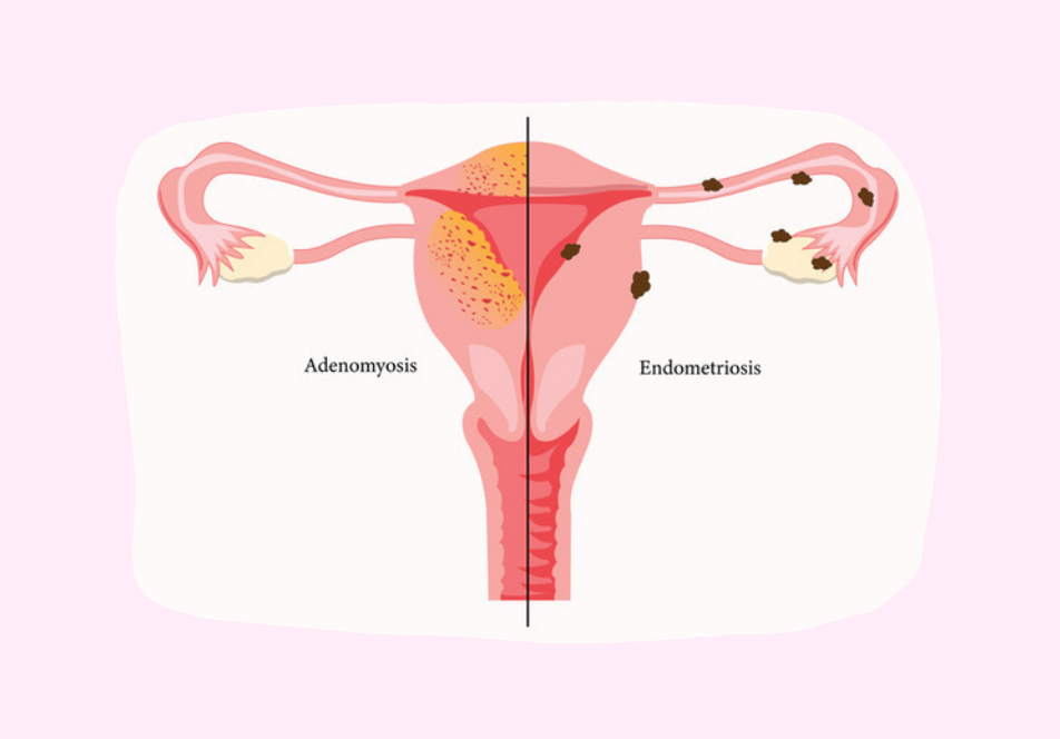 semaglutide 4 week results Semaglutide Before and After: Real Results