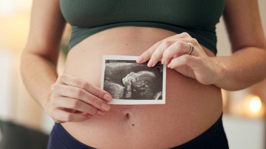 Close-up of a woman holding her ultrasound image